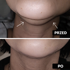 FINESSE FACE SCULT – OPASKA WYSMUKLAJĄCA