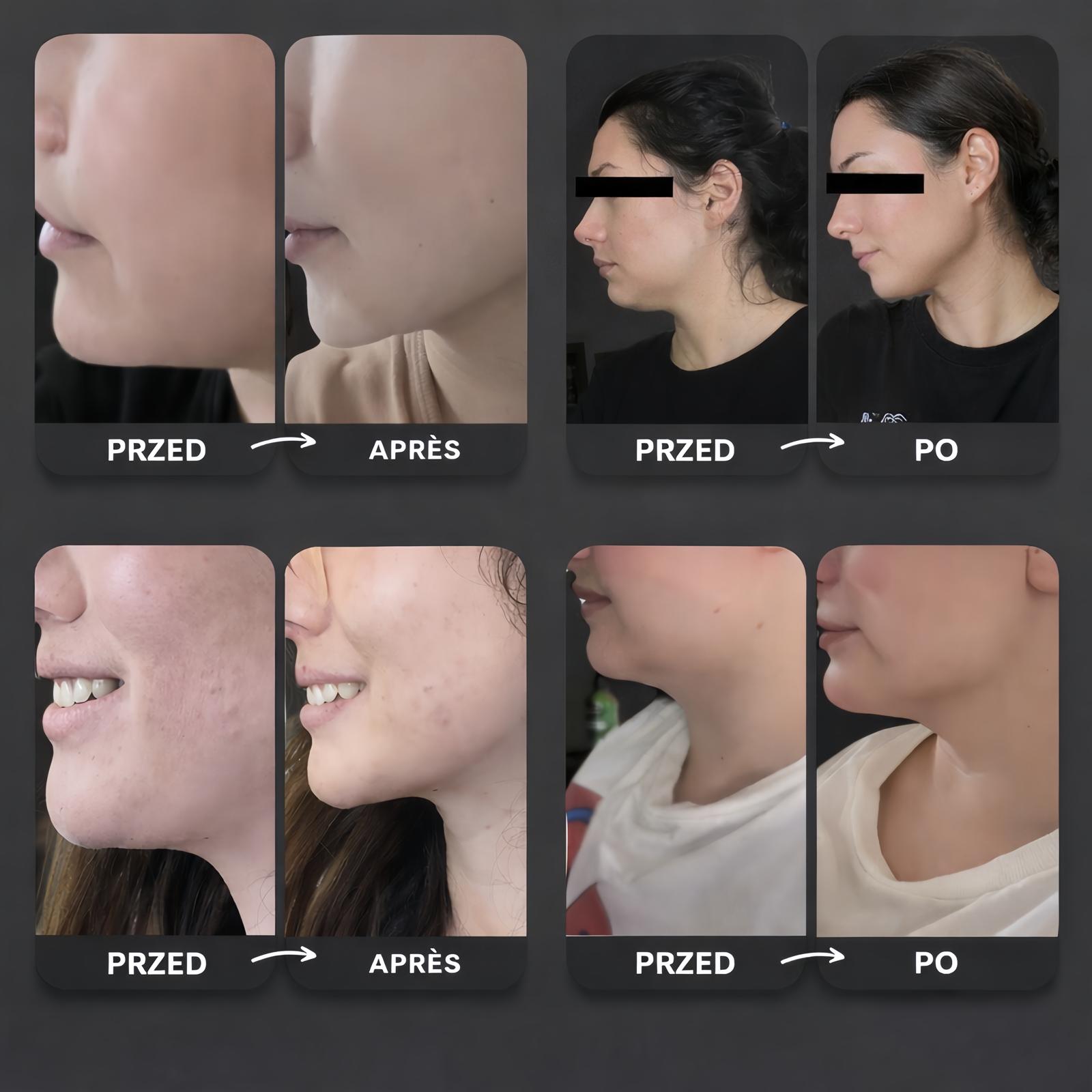 FINESSE FACE SCULT – OPASKA WYSMUKLAJĄCA